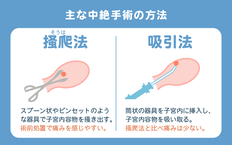 中絶手術の方法2種類(掻爬法・吸引法)