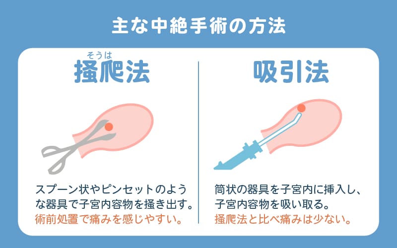 中絶手術の方法2種類（掻爬法・吸引法）