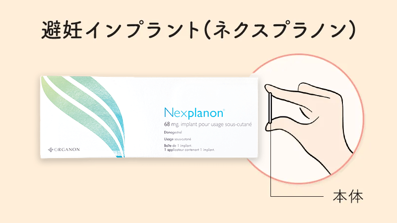 避妊インプラントの挿入器具と本体のイメージ